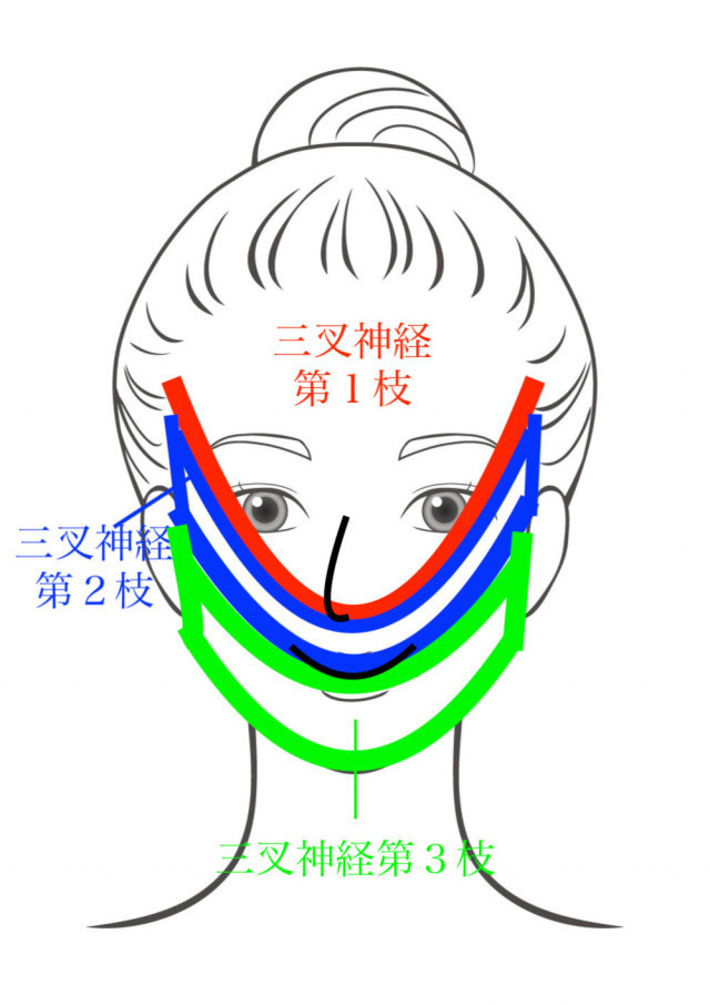 三叉神経痛とは?